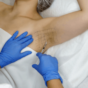 Patient receiving Hyperhidrosis treatment with a botulinum toxin injection to their armpit